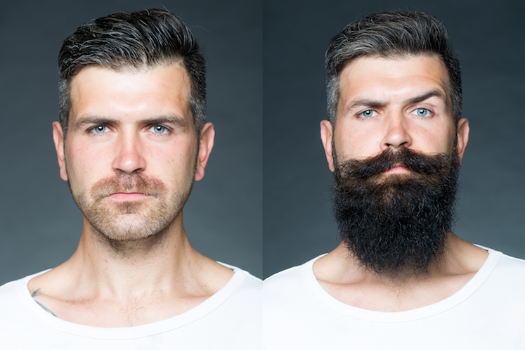 Wie funktionieren die Bartwuchsmittel