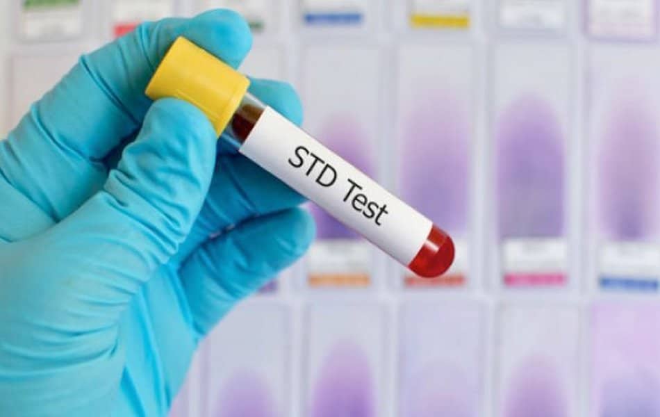 Come funziona il kit di test STD?