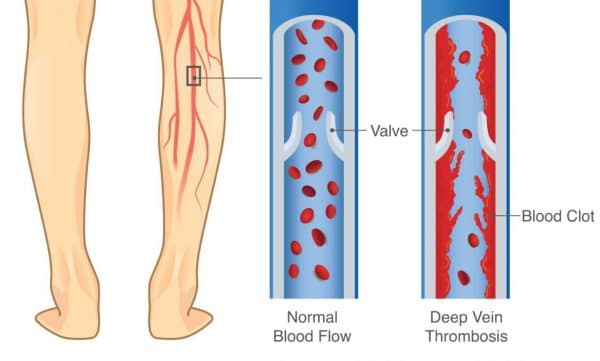 How does Revitive medic circulation booster work